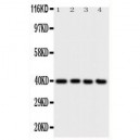 ATF4 Antibody