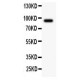 ATF6 Antibody