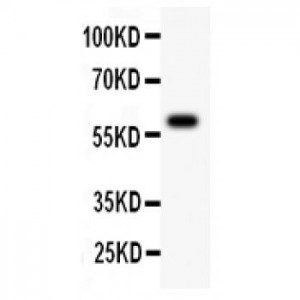 ATM  Antibody