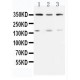 ATM Antibody