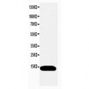 ATP5J Antibody