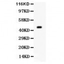 Aurora A Antibody