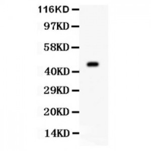 Aurora A Antibody