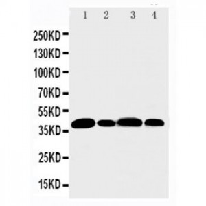 Aurora B Antibody