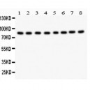 B Raf  Antibody