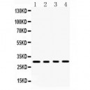 BAFF  Antibody