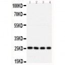 Bcl10 Antibody