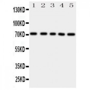 BCRP/ABCG2 Antibody