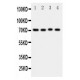 BCRP/ABCG2 Antibody