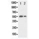 beta glucuronidase(GUSB) Antibody