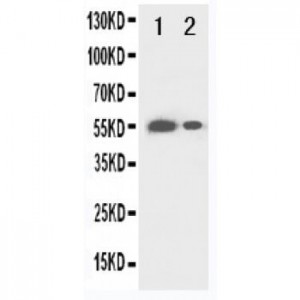 beta glucuronidase(GUSB) Antibody