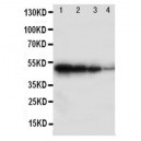 BMPR1B Antibody