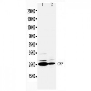 C Reactive Protein Antibody