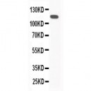 C5/C5a Antibody