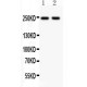 CACNA1C  Antibody