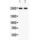 CACNA1C  Antibody