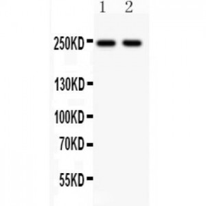 CACNA1C  Antibody