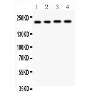 CACNA1F  Antibody