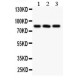 Calcineurin A  Antibody