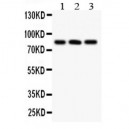 Calcineurin A  Antibody