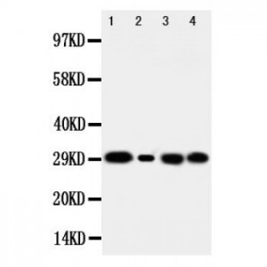 Carbonic Anhydrase I Antibody