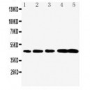 Caspase-1(P20) Antibody