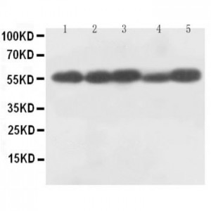 Caspase-8(P18) Antibody