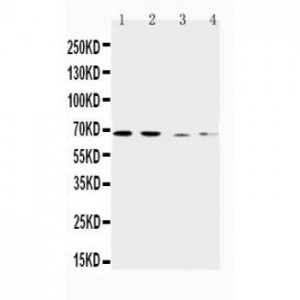 CAT1 Antibody