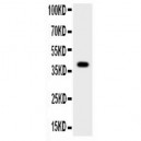 Cathepsin B  Antibody