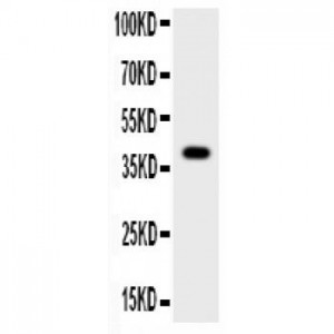 Cathepsin B  Antibody