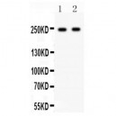 CaV1.3  Antibody