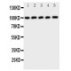 CBL Antibody