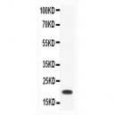 CCL18  Antibody