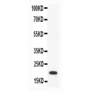 CCL18  Antibody