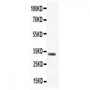 CCL3  Antibody