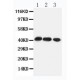 CCR4 Antibody