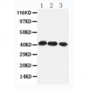 CCR4 Antibody