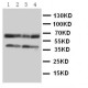 CCR5 Antibody