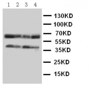 CCR5 Antibody