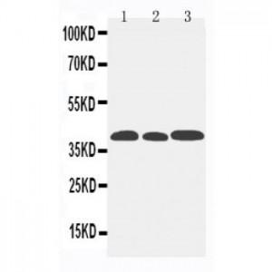 CCR5 Antibody