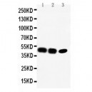 CCR6 Antibody