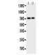 CD105  Antibody