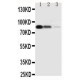 CD163 Antibody