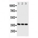 CD1a Antibody