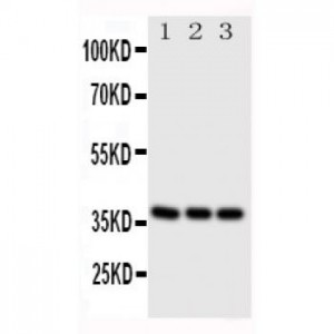 CD1a Antibody