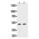 CD2 Antibody