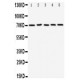 CD274 Antibody