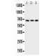 CD30 Antibody