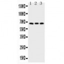 CD30 Antibody