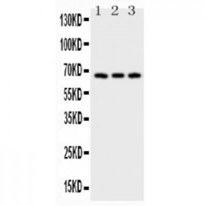 CD30 Antibody